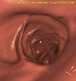 colongif.gif